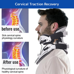 Neck Brace Support Orthosis - Adjustable Cervical Collar